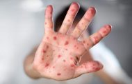 В Роспотребнадзоре заявили о нехватке в Дагестане вакцины от кори